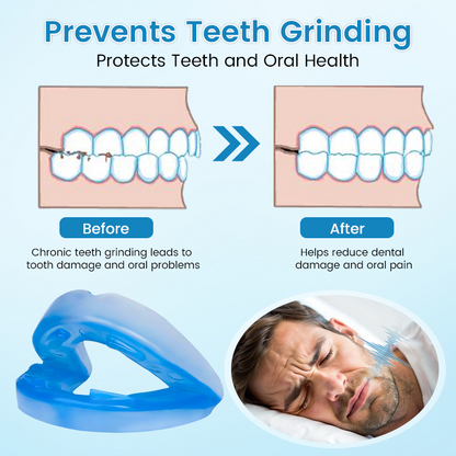 ✨QIAWI™ DreamGuard: Anti-Snoring & Teeth Grinding Mouthpiece