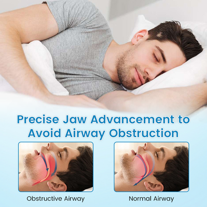 ✨QIAWI™ DreamGuard: Anti-Snoring & Teeth Grinding Mouthpiece